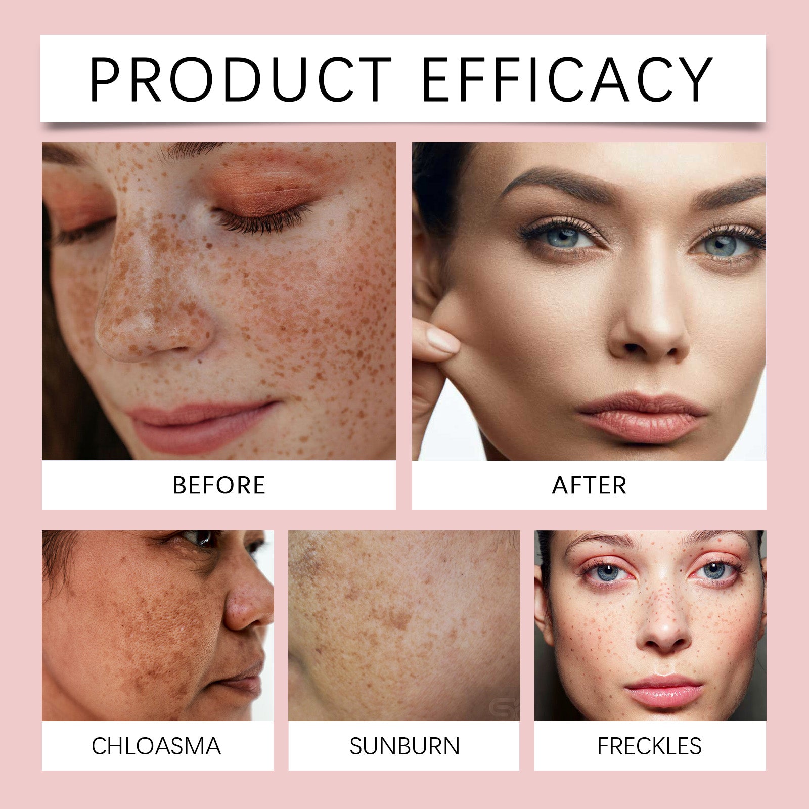 Freckle Whitening Brightening Serum, Brightening And Firming Skin Plant Extract
